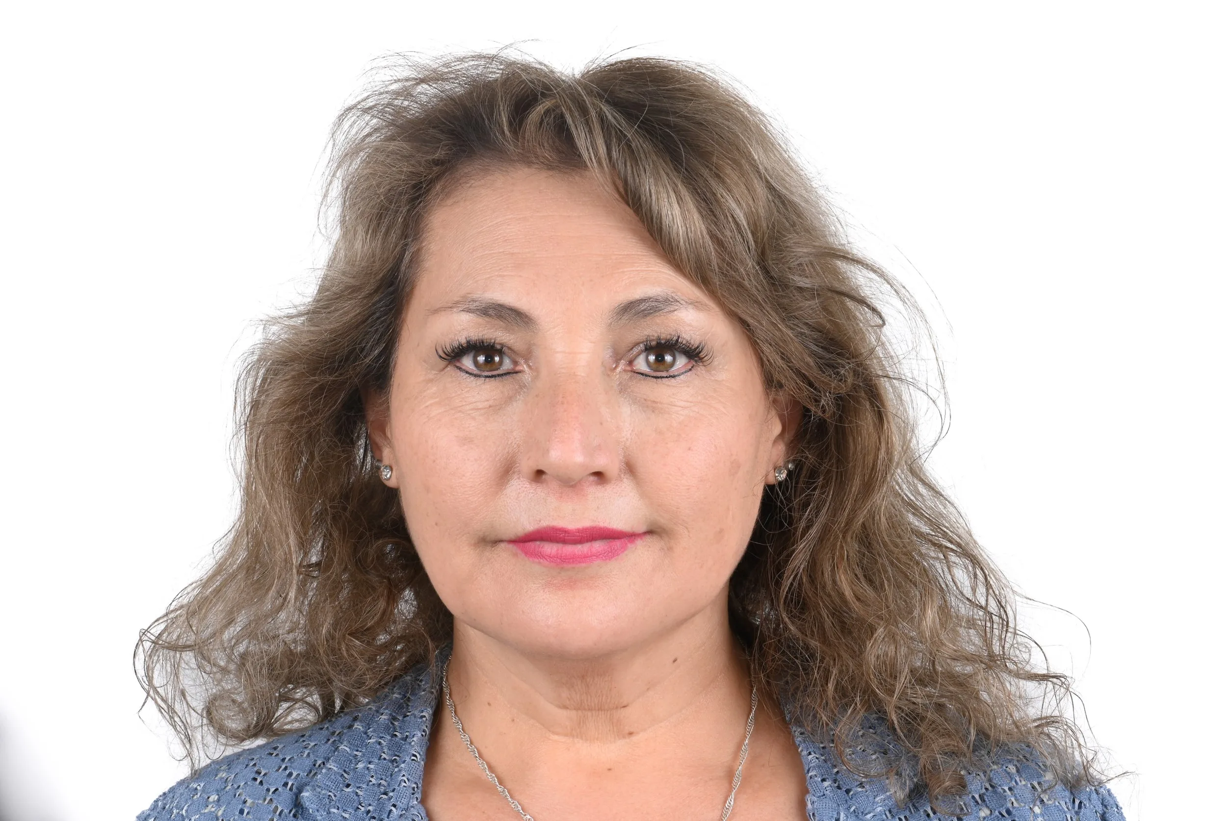 Caso clínico de Margarita 1